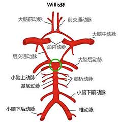 经颅多普勒（TCD）可检测的颅内动脉大盘点！