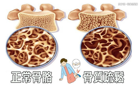国产骨密度仪生产厂家