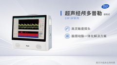 便携经颅多普勒超声生产厂家国产