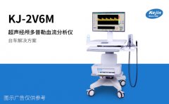 如何理解经颅多普勒检查报告?