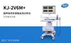 经颅多普勒提示血流速度减慢严重吗？